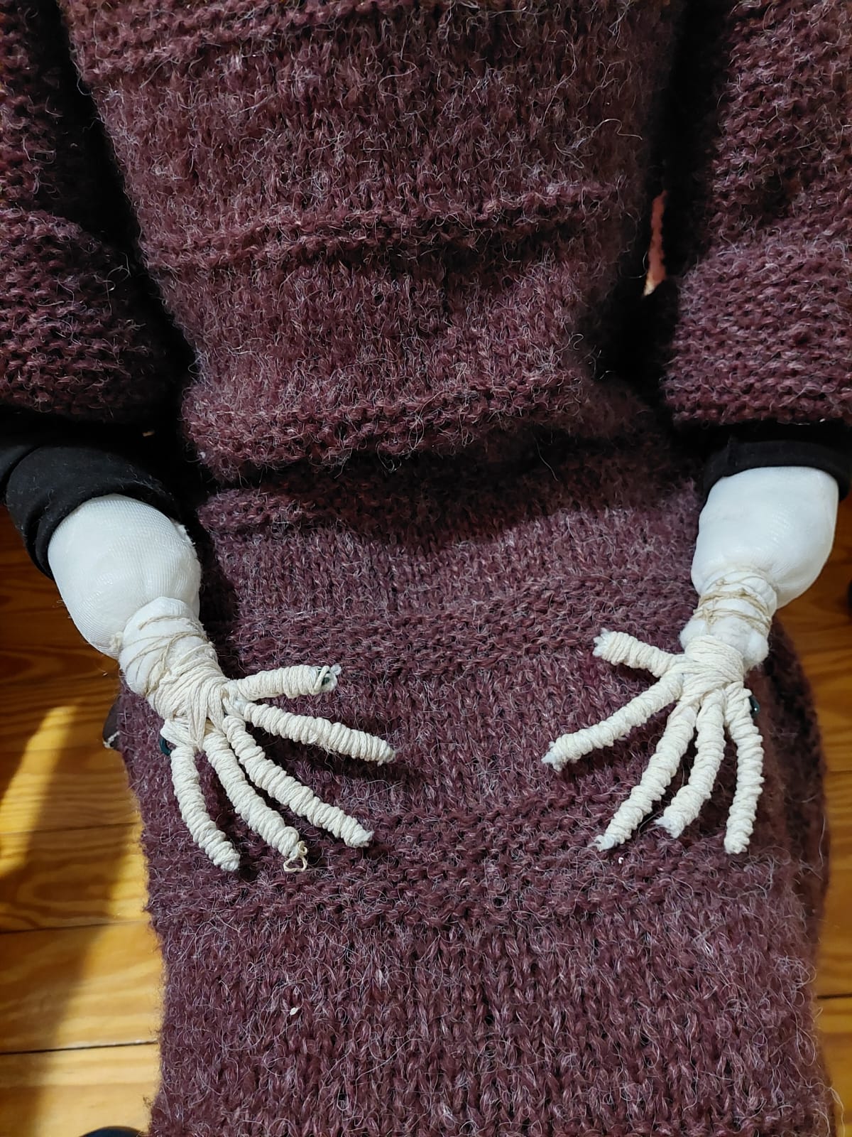 esqueleto de las manos 11